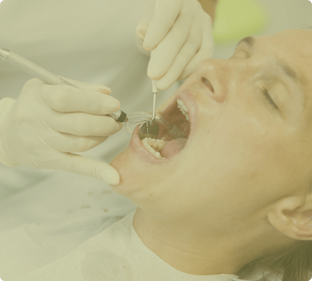 Root Canals | Main Street Dental Airdrie